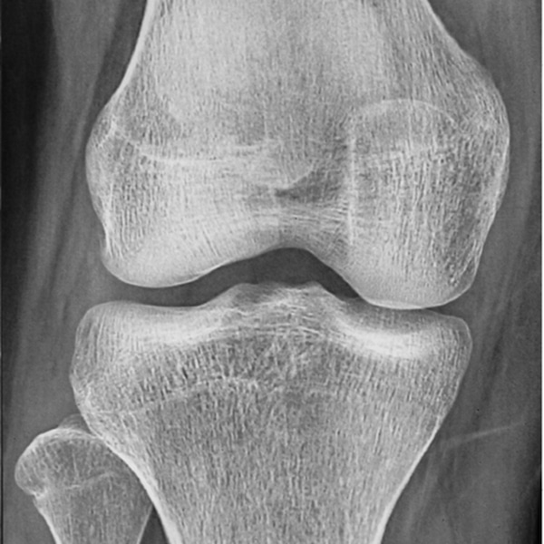 SW Diagnostic   slide 2