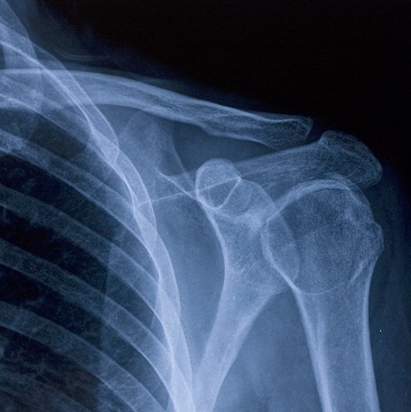 SW Diagnostic   slide 4